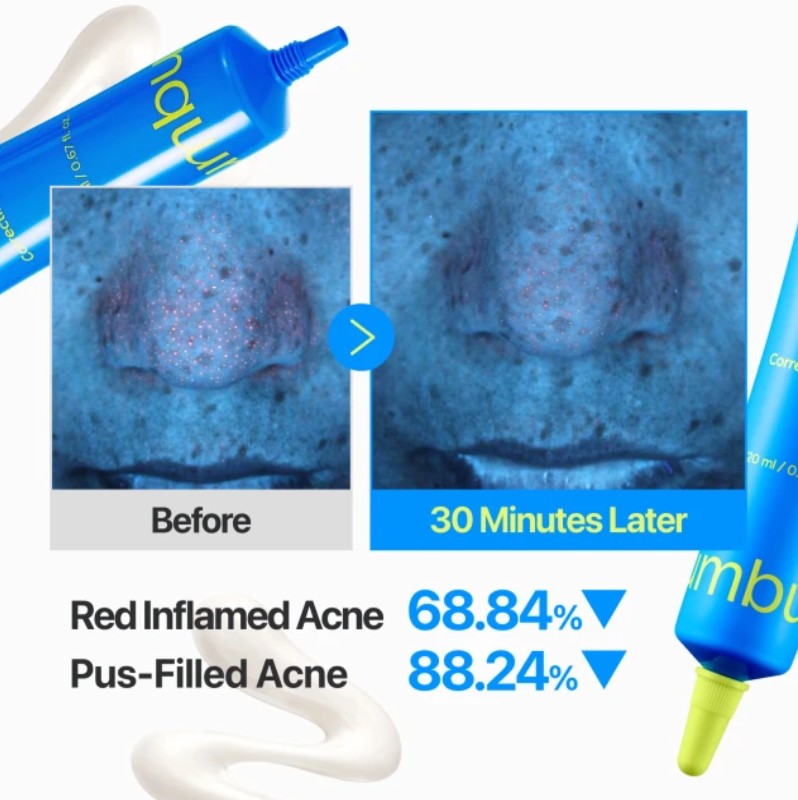 NUMBUZIN ZERO BLEMISH 3X SPOT CORRECTING CREAM 20ML