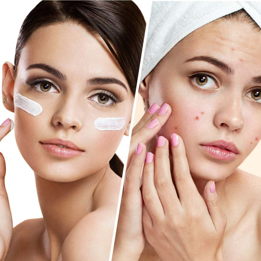 BIOVENE BLEMISH CONTROL MOISTURIZER 50ML - Beauty Bar