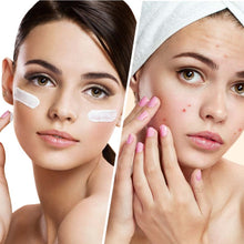 Load image into Gallery viewer, BIOVENE BLEMISH CONTROL MOISTURIZER 50ML - Beauty Bar 
