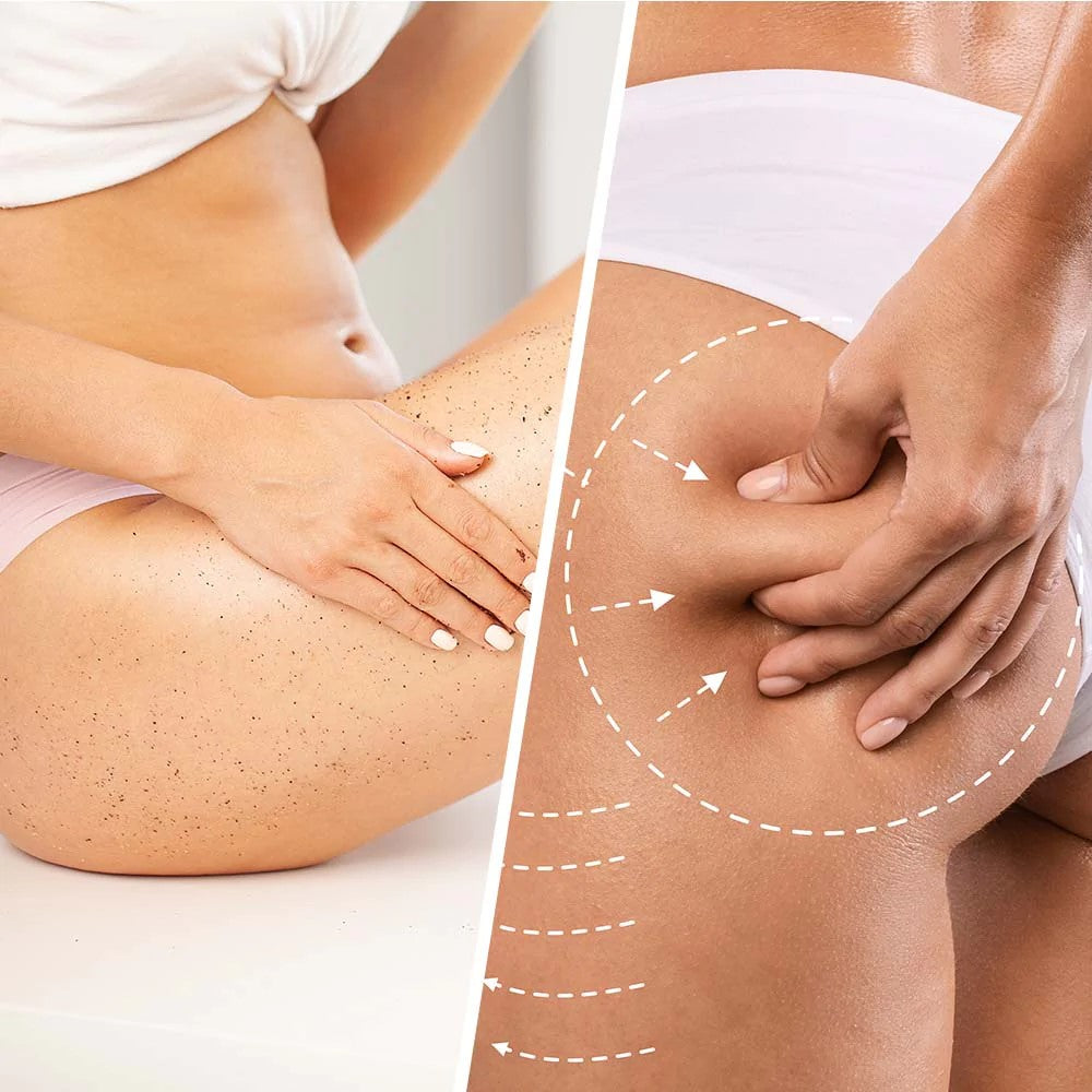 BIOVENE NIACIN ANTI-CELLULITE BODY SCRUB 250ML - Beauty Bar 